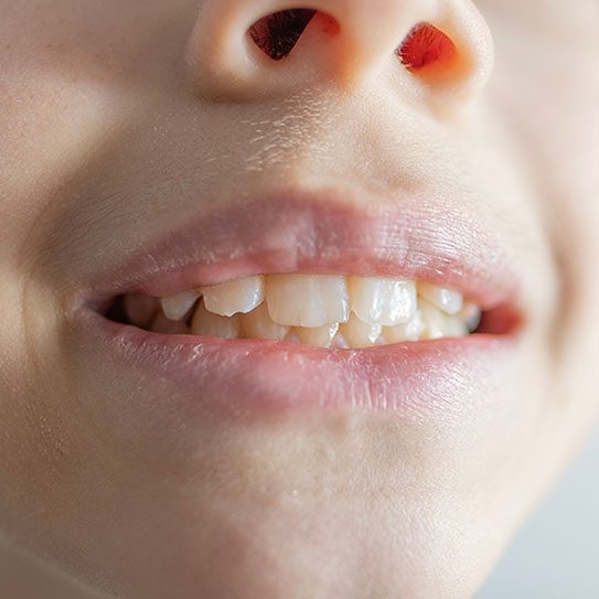 Dentist in Mesa