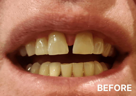 before-9-new before-9-new