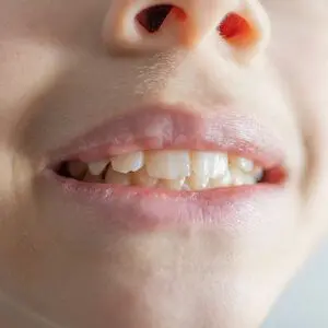 Dentist in Mesa