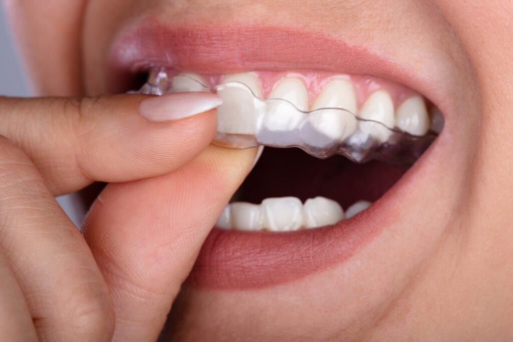 Dentist in Mesa