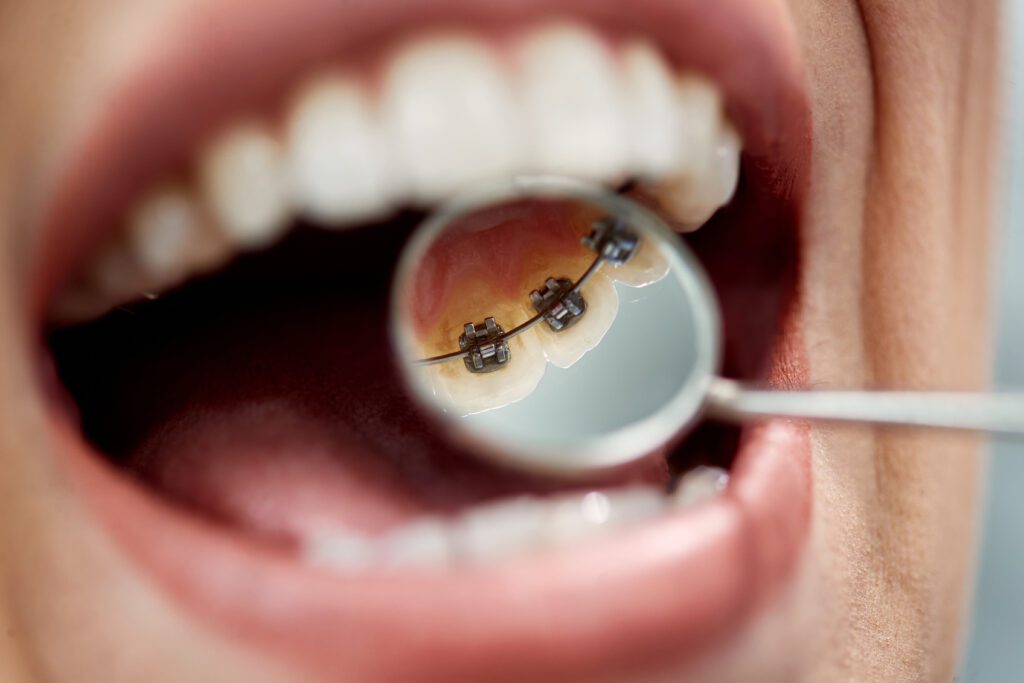 Dentist in Mesa